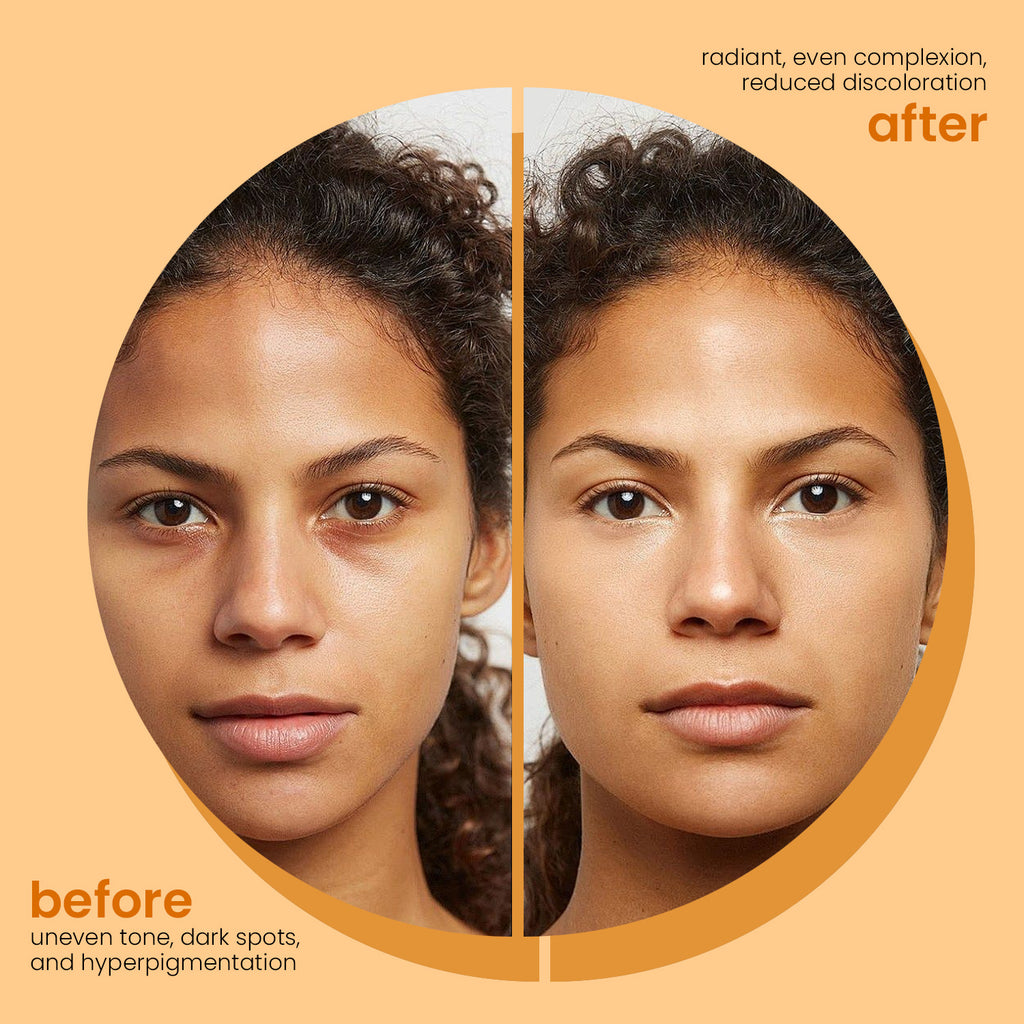 Cross-border Explosions Turmeric Soap Kojic Acid Soap Lemon Turmeric Soap Cleaning Bath Face Handmade Soap Ginger Particles Soap